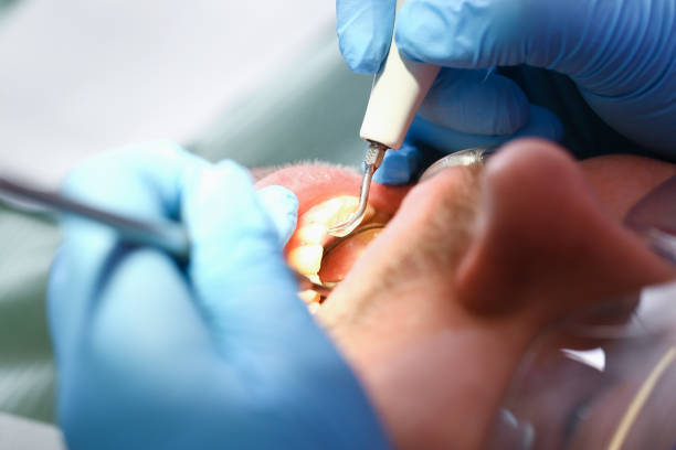 Best Emergency Tooth Extraction in North Middletown, NJ